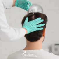 FUE Hair Transplant in Mexico City, Mexico: What Should Patients Compare Before Choosing Care?